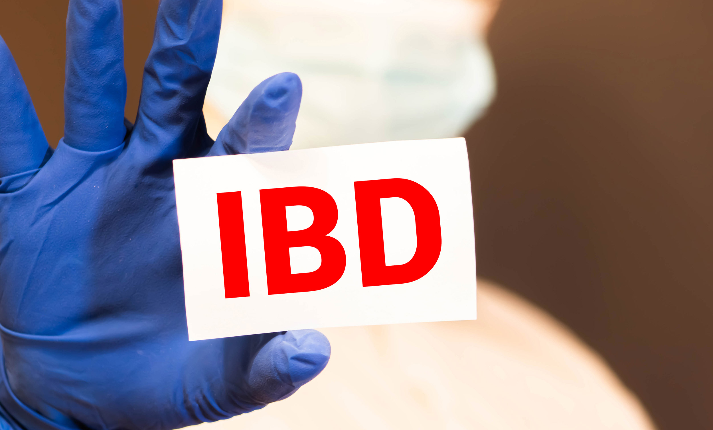 How Often Should IBD Patients Undergo Colonoscopy?