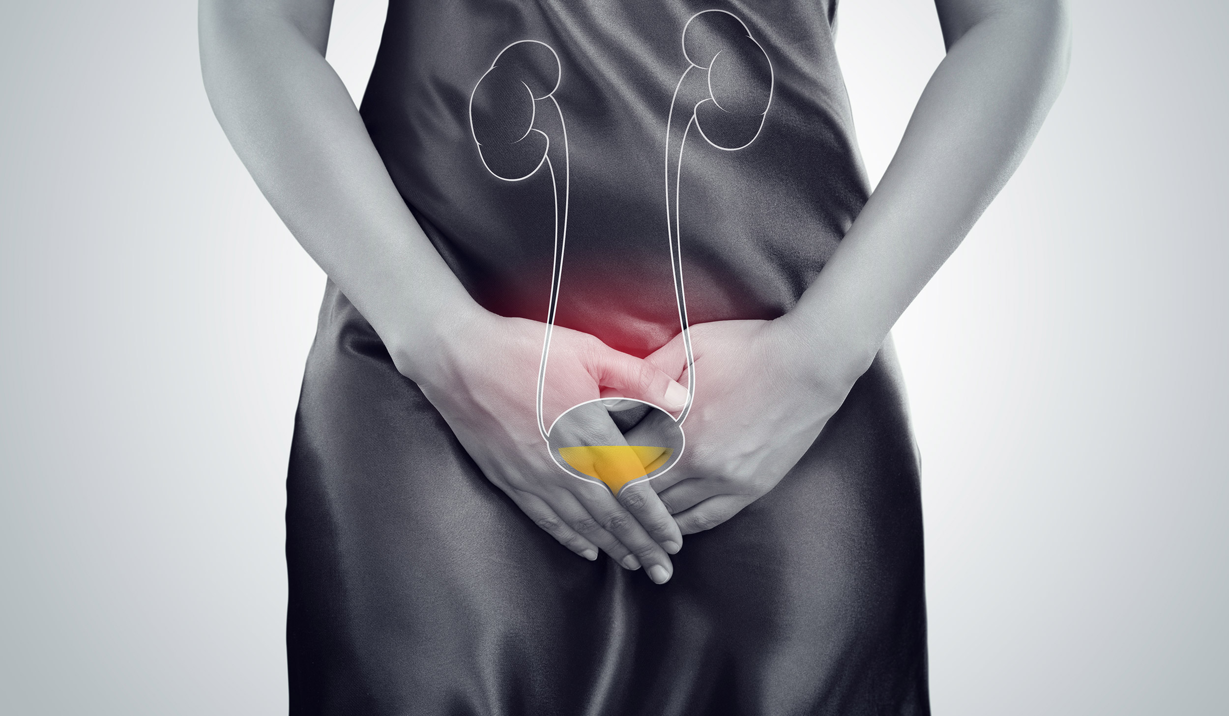 Bladder Cancer Awareness Month: Why Are Women Diagnosed Later than Men? 