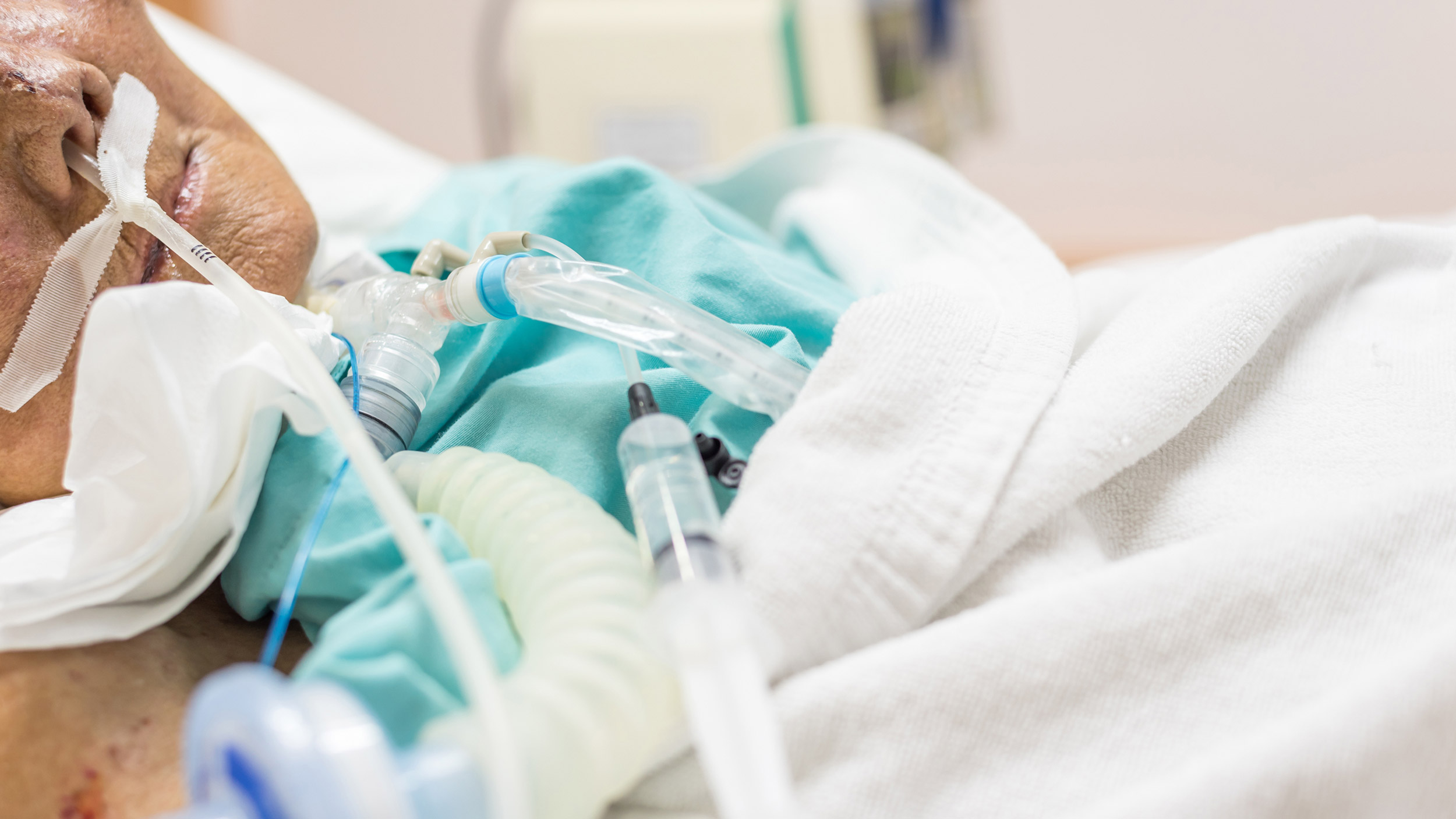 Can Combining Pulmonary and GI Procedures Shorten Hospital Stays?